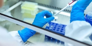 Rusya-Sibiryadaki-Laboratuvar-Calisaninda-Veba-Bulunmadi-featured